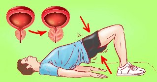 Exercício para prostatite