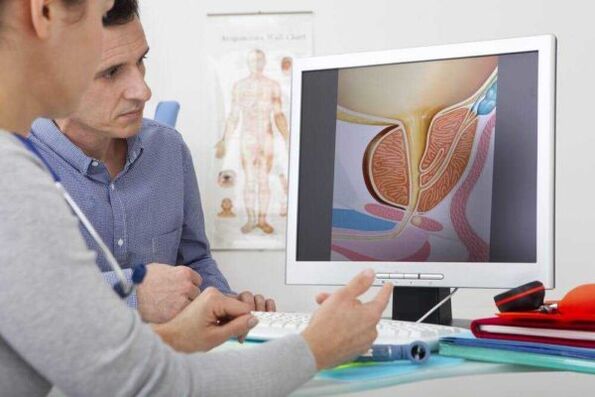 o médico consulta o paciente sobre a questão da prostatite