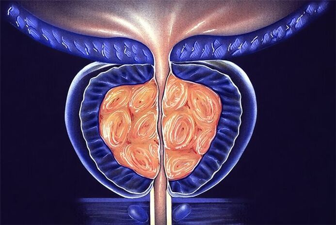 sintomas e tratamento da prostatite
