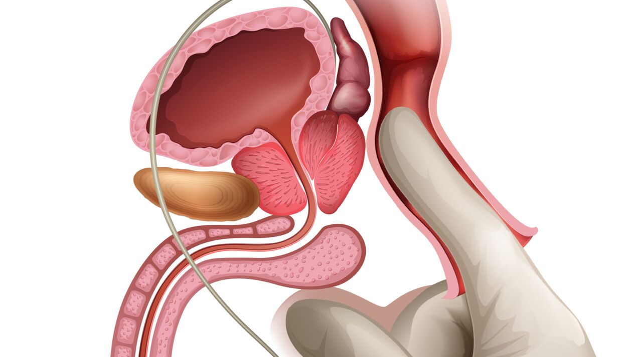 A massagem da próstata é uma forma eficaz de tratar a prostatite congestiva
